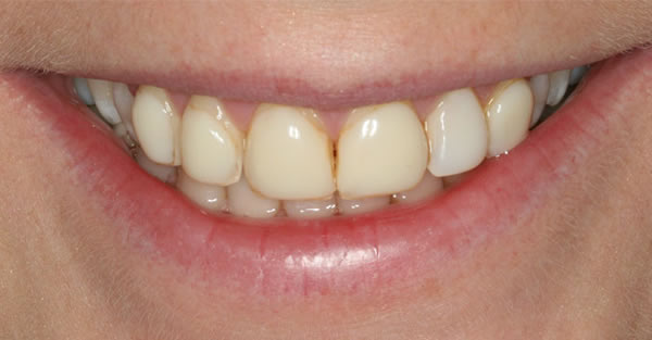 Cosmetic Dentistry Services Wisconsin